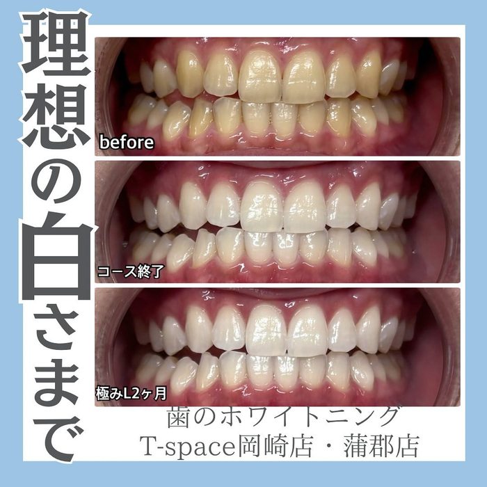 画像1006