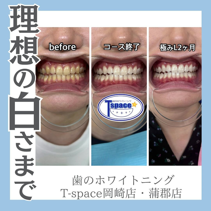 画像1007