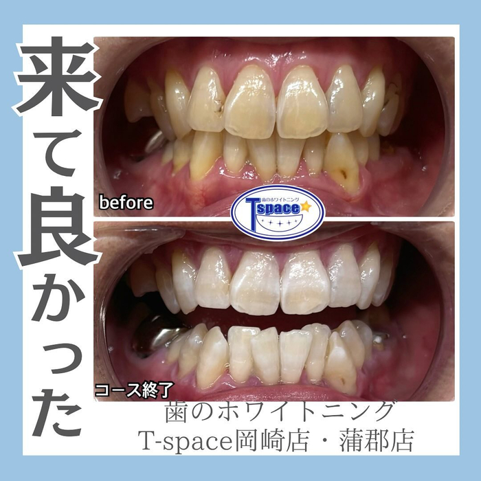 画像1012