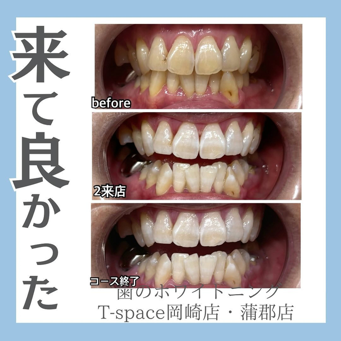 画像1013