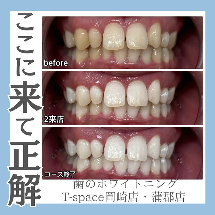 画像1022