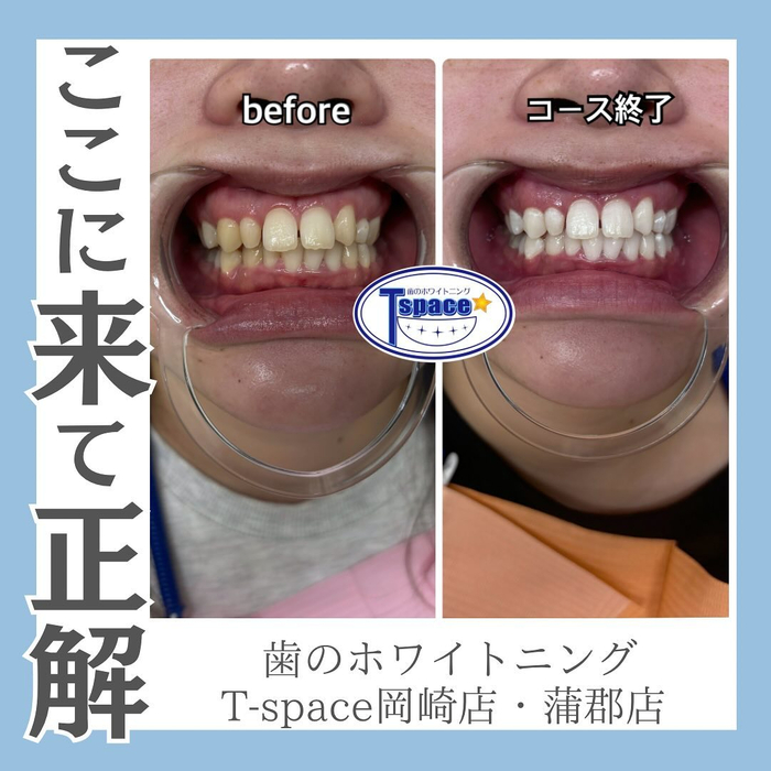 画像1023
