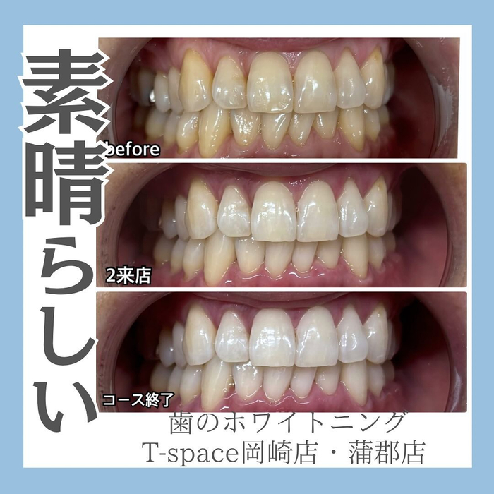 画像1034