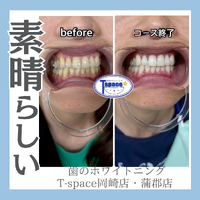 画像1035