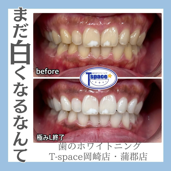 画像1043