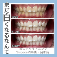 画像1044