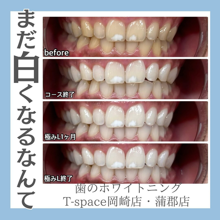 画像1045
