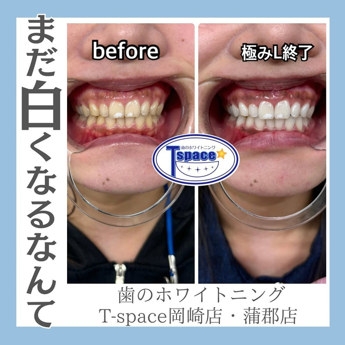 画像1046