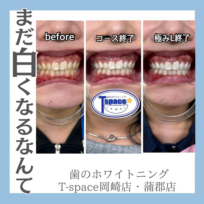 画像1047