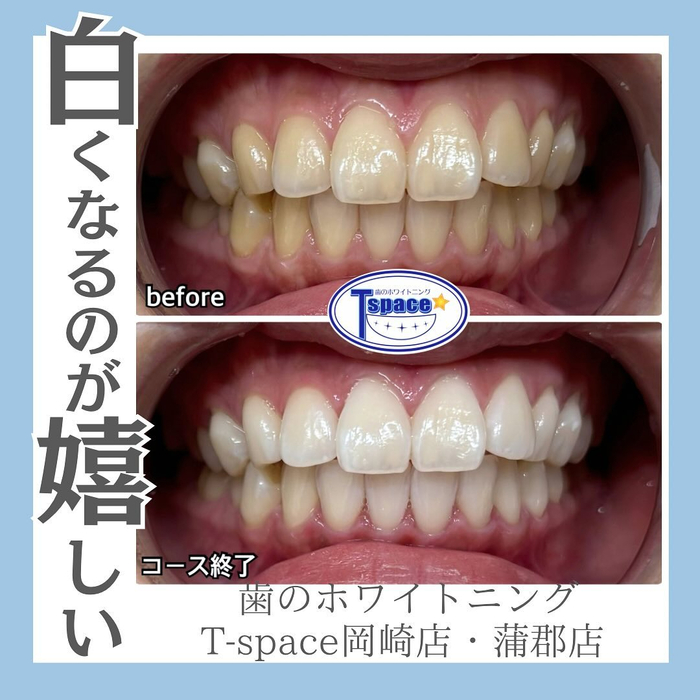画像1053