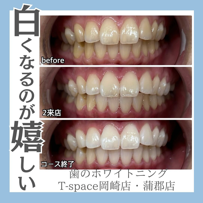 画像1054