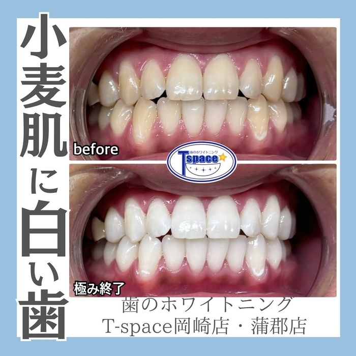 画像1062