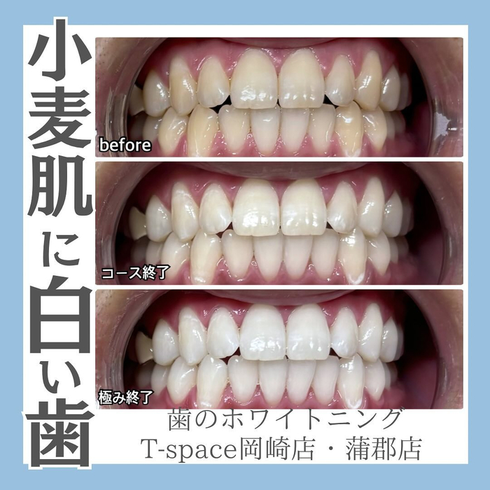 画像1063