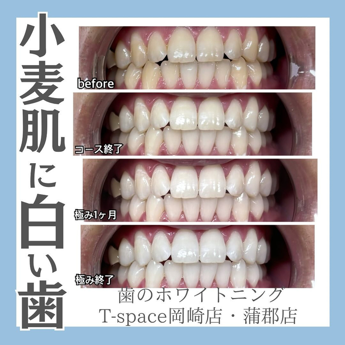 画像1064