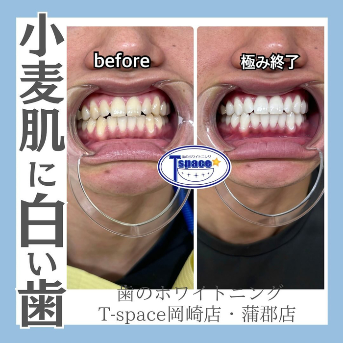 画像1065