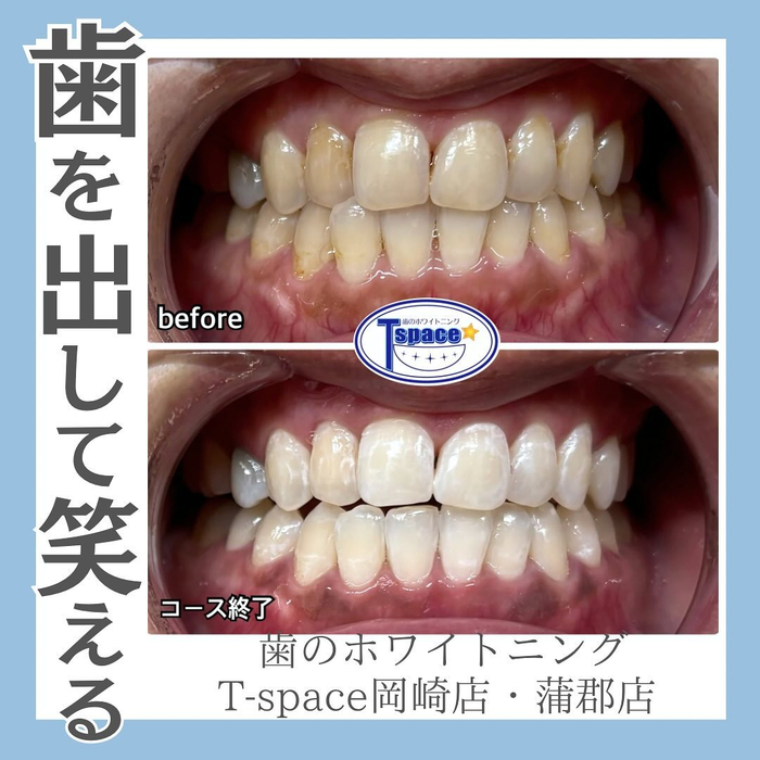 画像1072