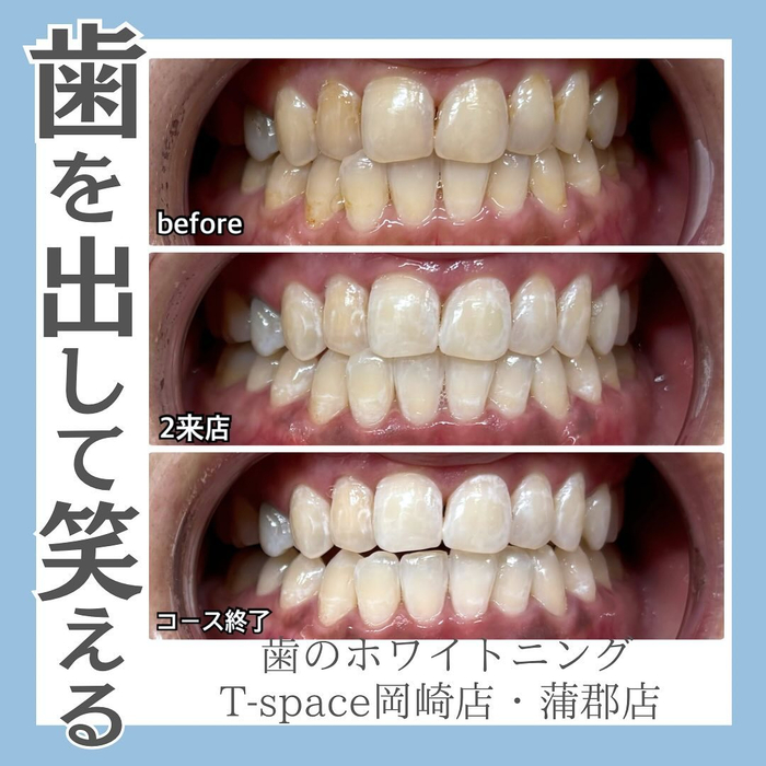 画像1073