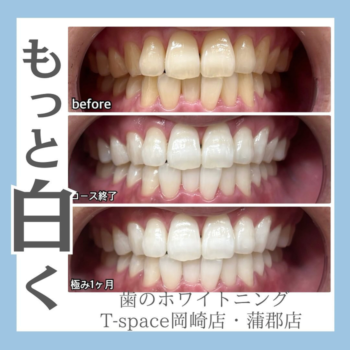 画像1091