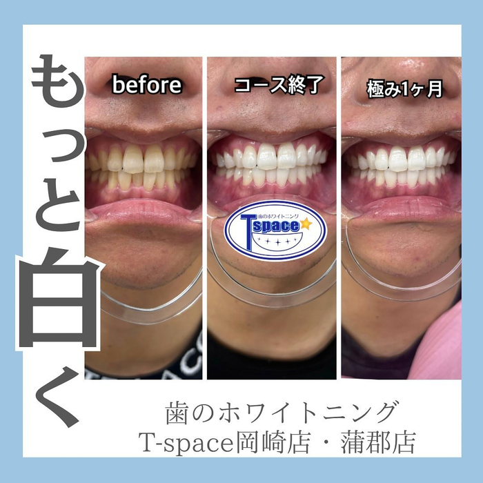 画像1092