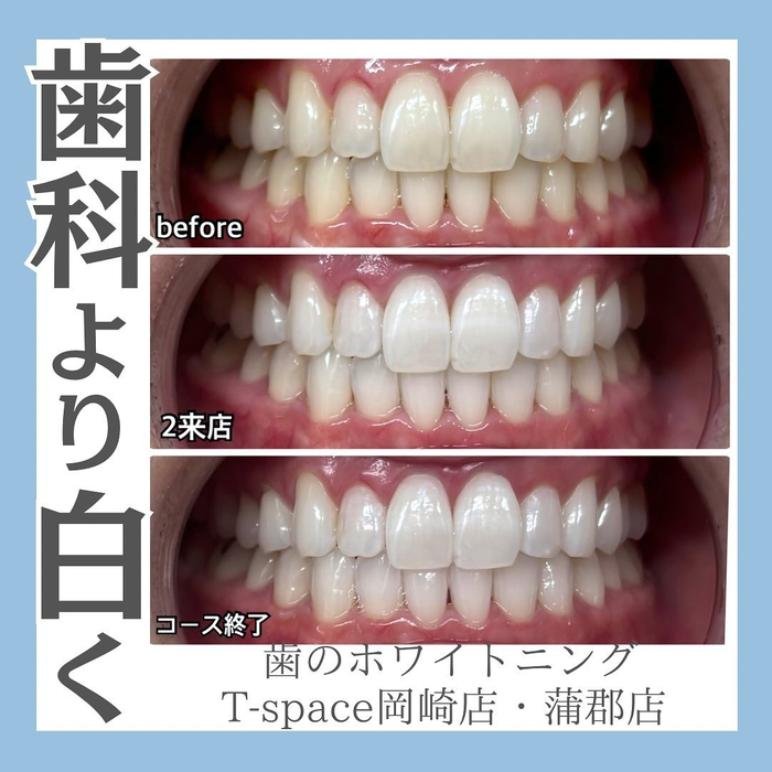 画像1098