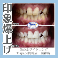 画像1106