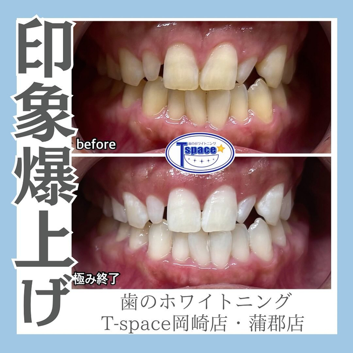 画像1106