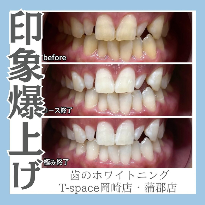 画像1107