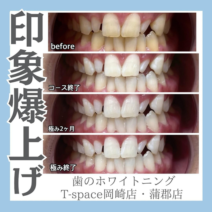 画像1108