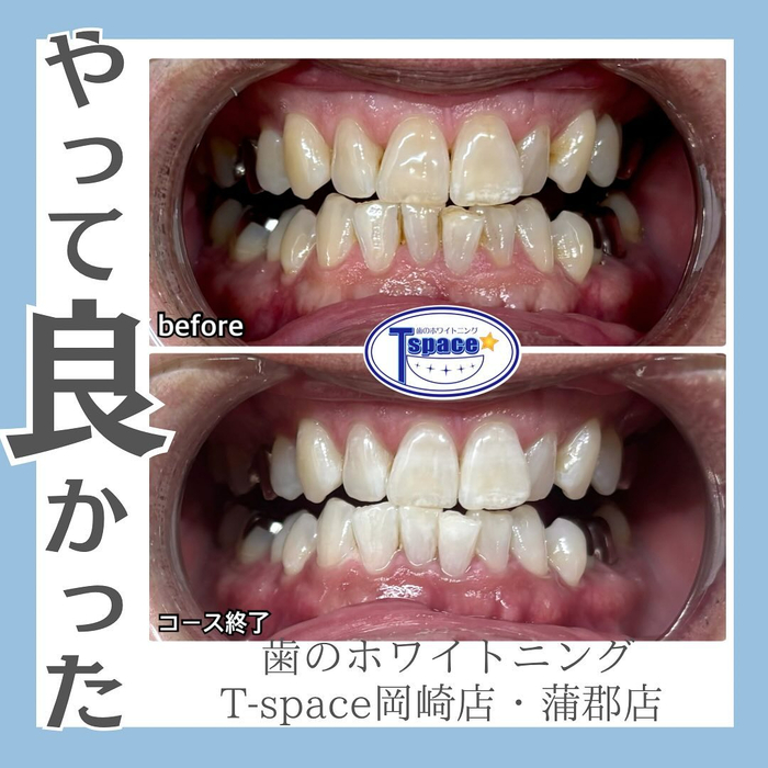 画像1114