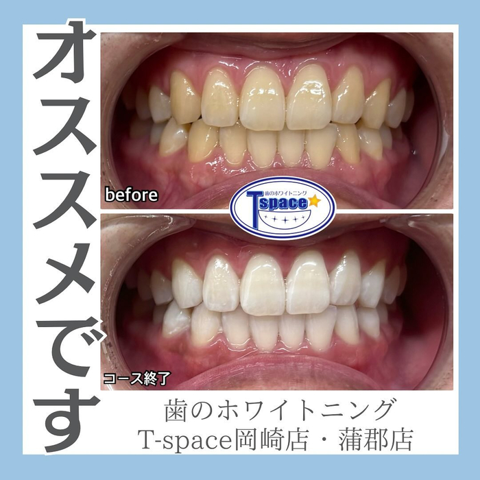 画像1122