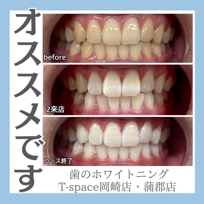 画像1123