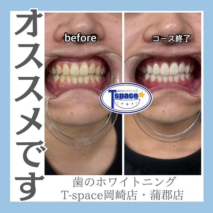 画像1124