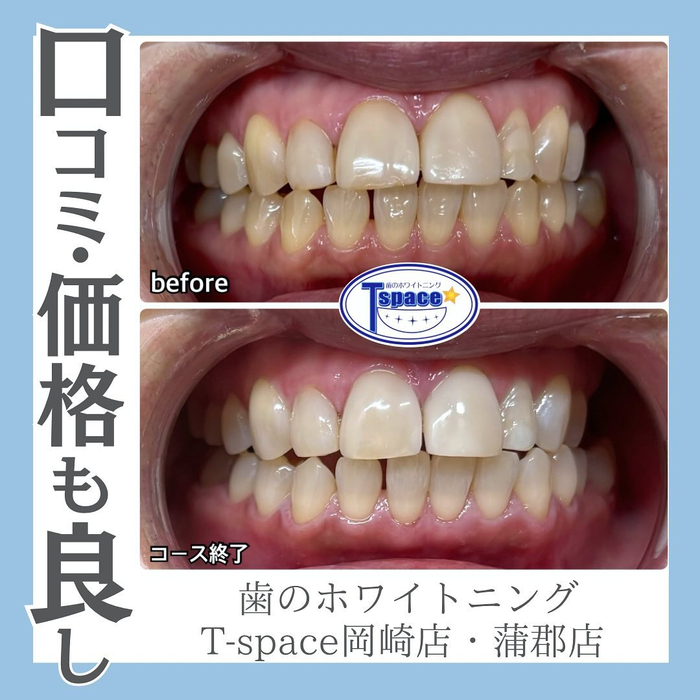 画像1132