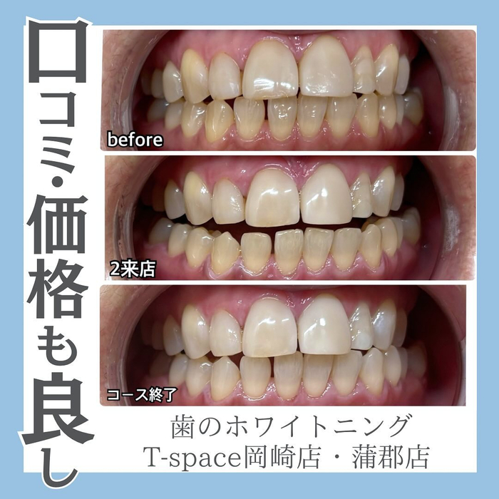 画像1133
