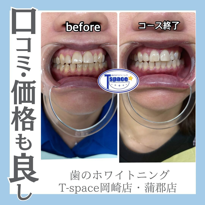 画像1134