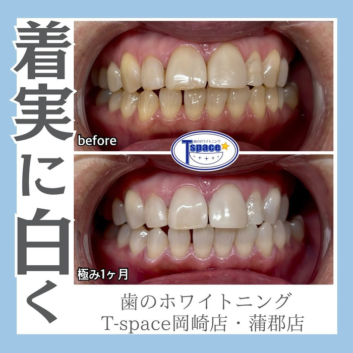 画像1142