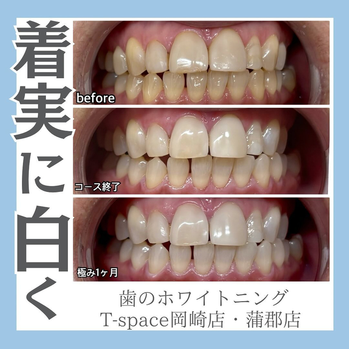 画像1143