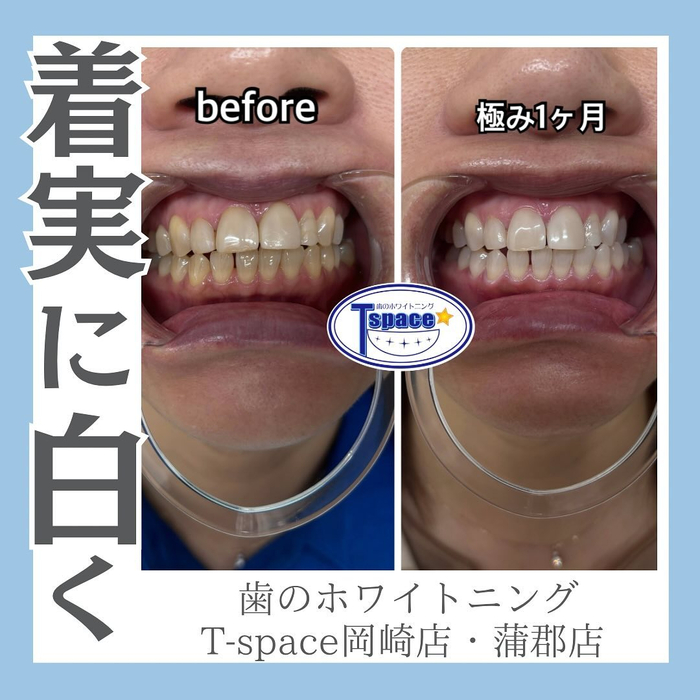 画像1144