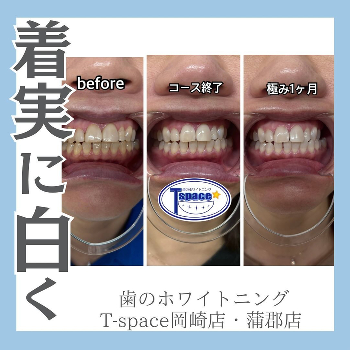 画像1145