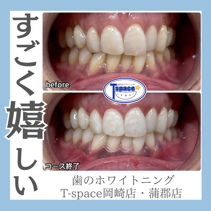 画像1151
