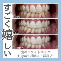 画像1152