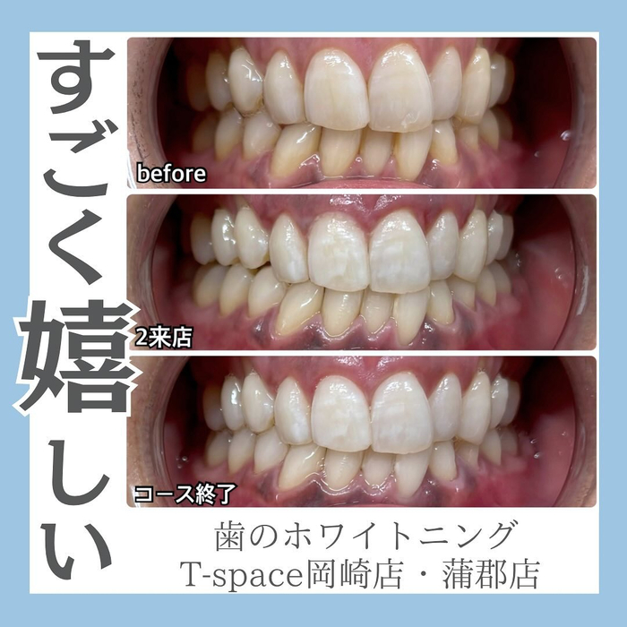 画像1152