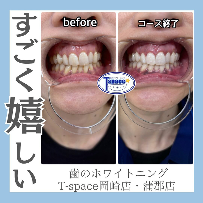 画像1153