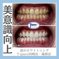 画像1161
