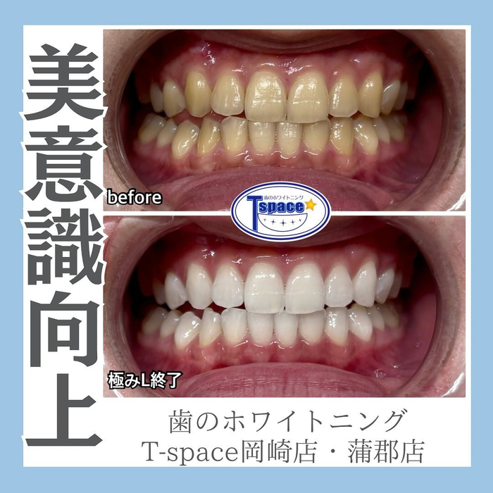 画像1161