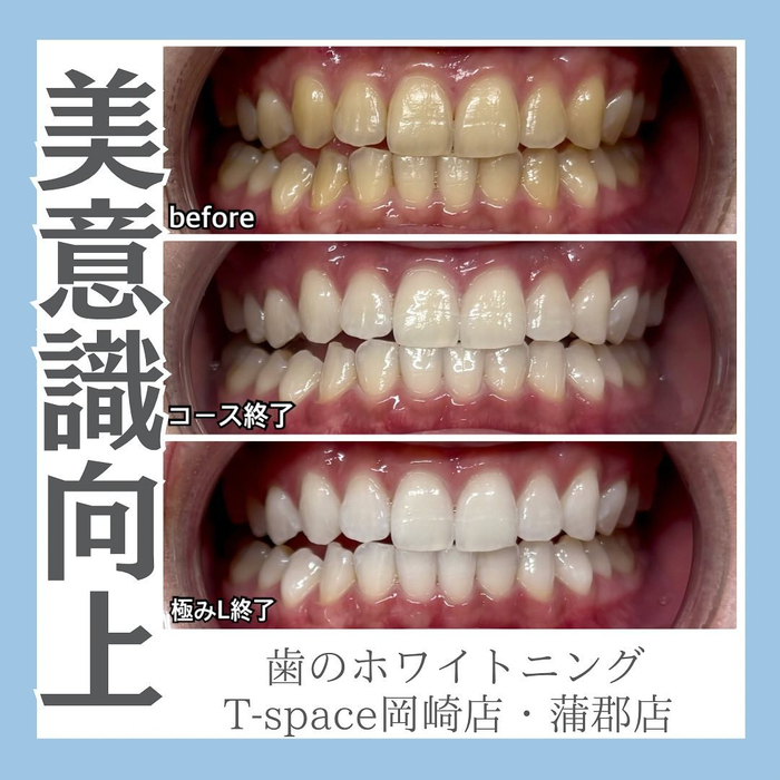 画像1162