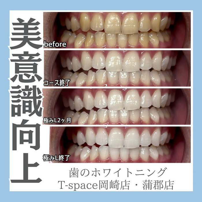 画像1163