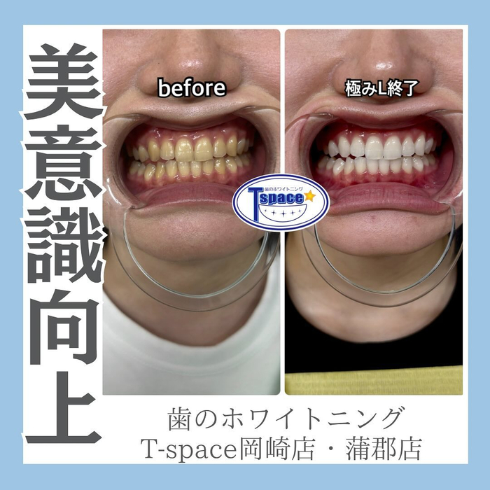 画像1164