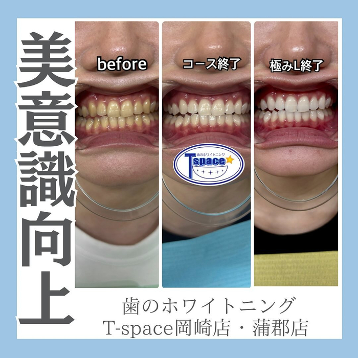 画像1165