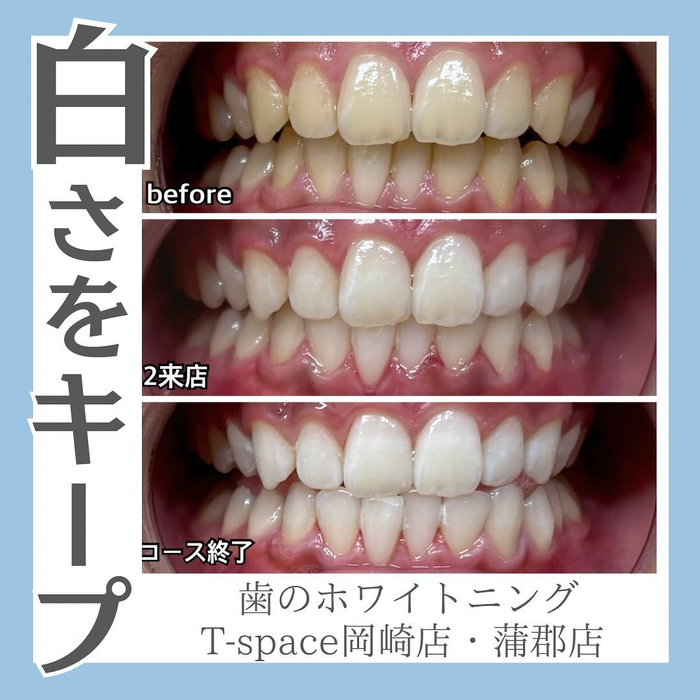 画像1172